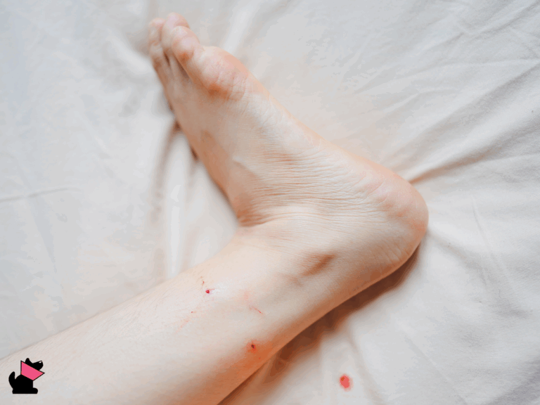 Co zrobić po pokąsaniu przez zwierzę?